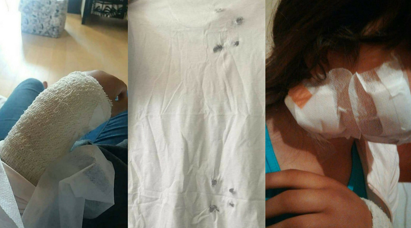 Ozlijeđeno dijete izbjeglica i propucana majica