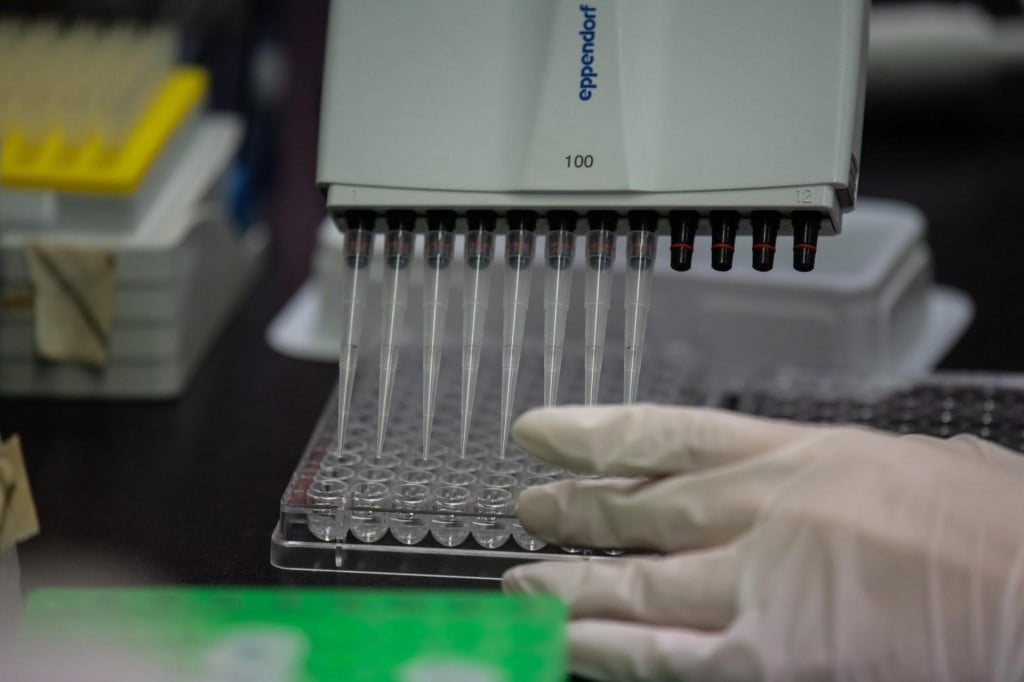 This photo taken on March 11, 2020 shows a lab techician working on a neutralising antibody test on the Middle Eastern Respiratory Syndrome (MERS) coronavirus at a Bio Safety Level (BSL) 3 laboratory at the International Vaccine Institute (IVI) in Seoul. - The COVID-19 novel coronavirus outbreak has exposed a lack of global research on ways to combat the spread of infectious diseases, with health authorities failing to learn lessons from previous flare-ups, experts said on March 3. The last outbreak of worldwide signficance was the SARS virus scare of the early 2000s, which killed 774 people, and more recently the Mers virus killed more than 850 people, although the outbreak was largely contained to the Middle East. (Photo by Ed JONES/AFP)