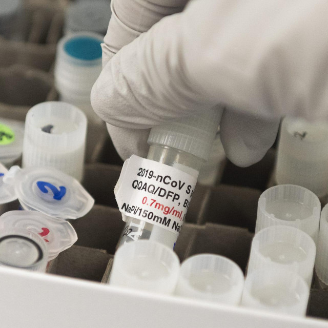 (FILES) In this file photo Dr. Nita Patel, Director of Antibody discovery and Vaccine development, lifts a vial with a potential coronavirus, Covid-19, vaccine at Novavax labs in Gaithersburg, Maryland, one of the labs developing a vaccine for the coronavirus, Covid-19. - The US Food and Drug Administration made public its guidance for issuing emergency approval for a Covid-19 vaccine on October 6, 2020, making it clear it wants to see follow-up two months after trial volunteers have their second dose. (Photo by ANDREW CABALLERO-REYNOLDS/AFP)