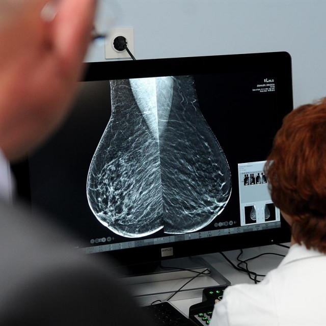 Projekt prevencije i rane dijagnoze raka dojke