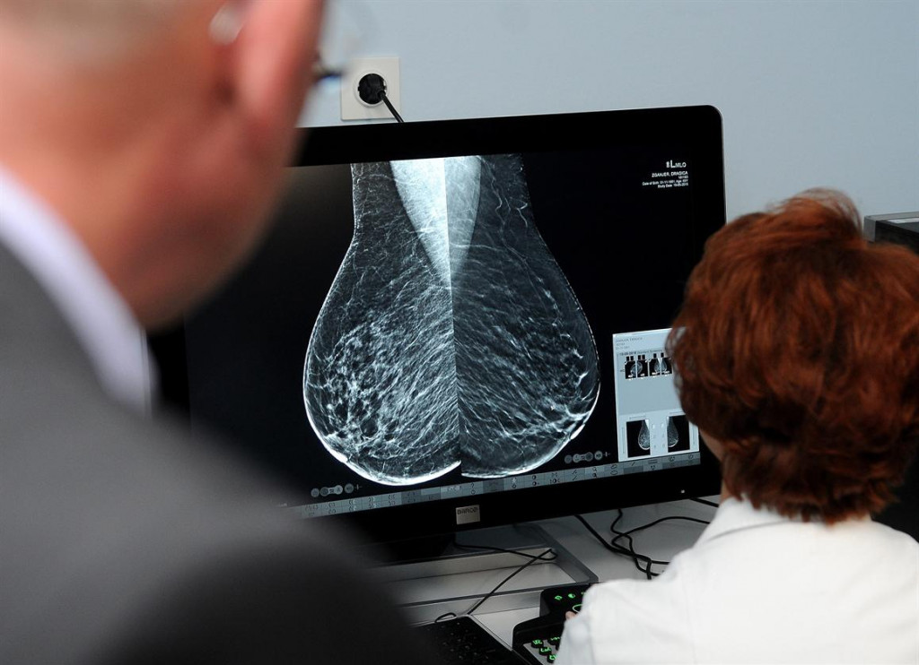 Projekt prevencije i rane dijagnoze raka dojke