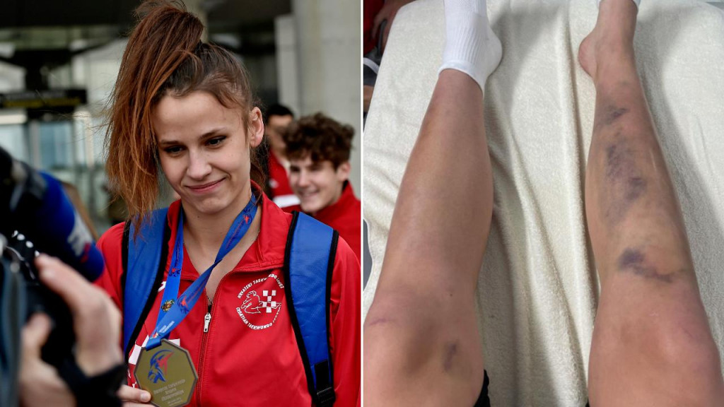 Matea Jelić europska je prvakinja u taekwondou, a objavom na instagramu je pokazala kako je put do trona bio i više nego težak