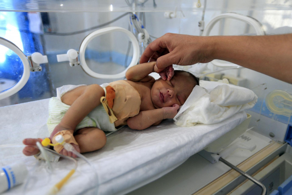 Jedno od prerano rođene djece u inkubatoru (ilustracija)