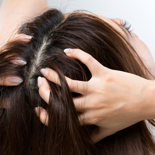 Kad su pore na tjemenu začepljene, to će imati negativan efekt na cijelu našu kosu