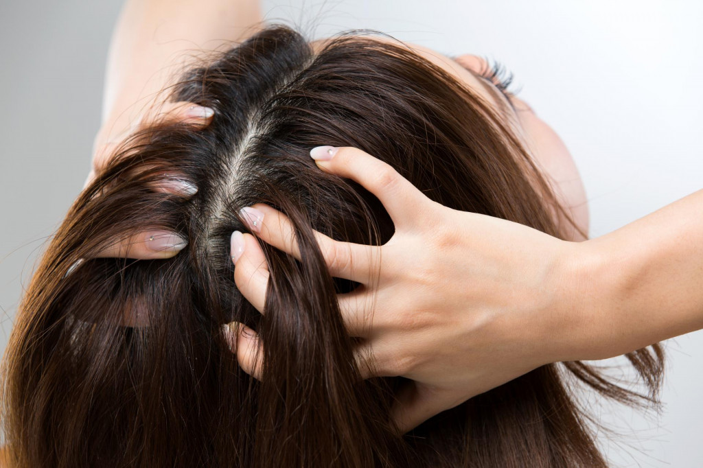 Kad su pore na tjemenu začepljene, to će imati negativan efekt na cijelu našu kosu