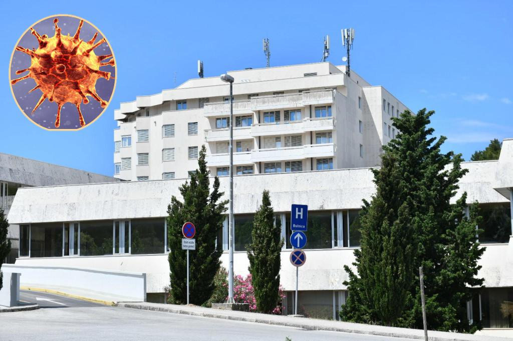 Zbog infekcije koronavirusom u Općoj bolnici Dubrovnik hospitalizirana je 61 osoba