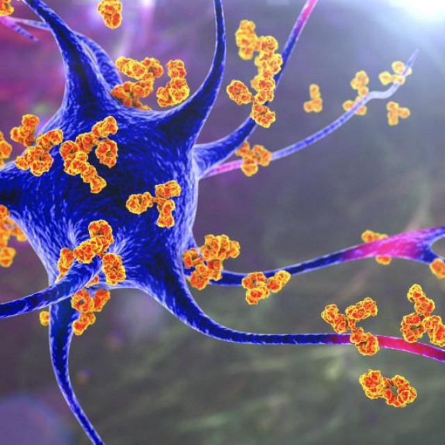 Antitijela koja napadaju neurone. Konceptualna računalna ilustracija autoimunih neuroloških bolesti