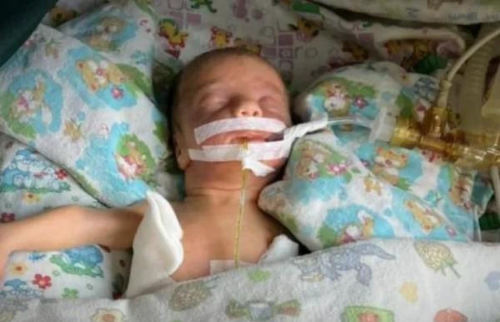 Mala Alba rođena 10 tjedana prije termina u ukrajinskoj Odesi