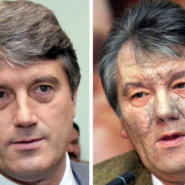 Viktor Juščenko prije i nakon trovanja 
