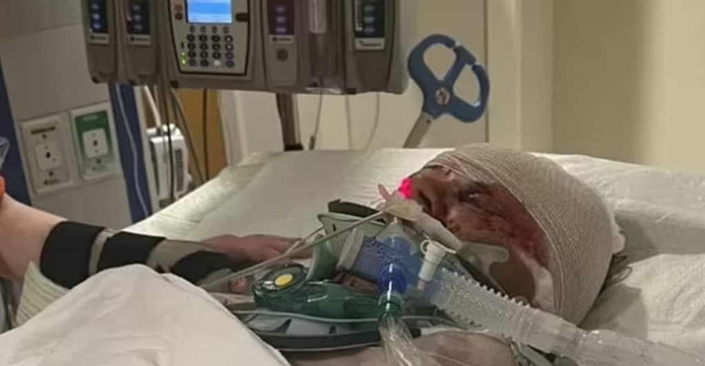 &lt;p&gt;Nesretna Kyleen Waltman u bolnici se bori za život, čekaju je i nove teške operacije&lt;/p&gt;
