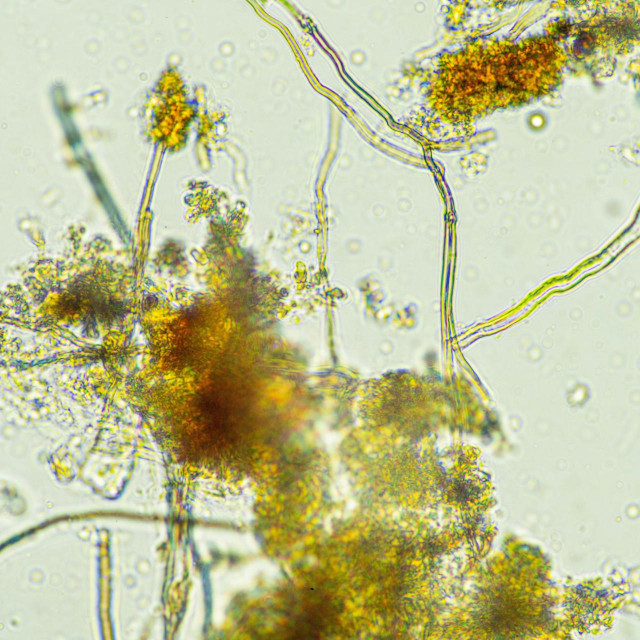 &lt;p&gt;microorganisms and soil biology, with nematodes and fungi under the microscope.&lt;/p&gt;