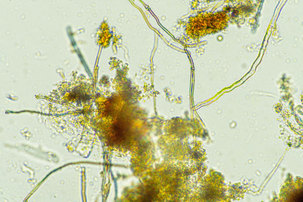&lt;p&gt;microorganisms and soil biology, with nematodes and fungi under the microscope.&lt;/p&gt;