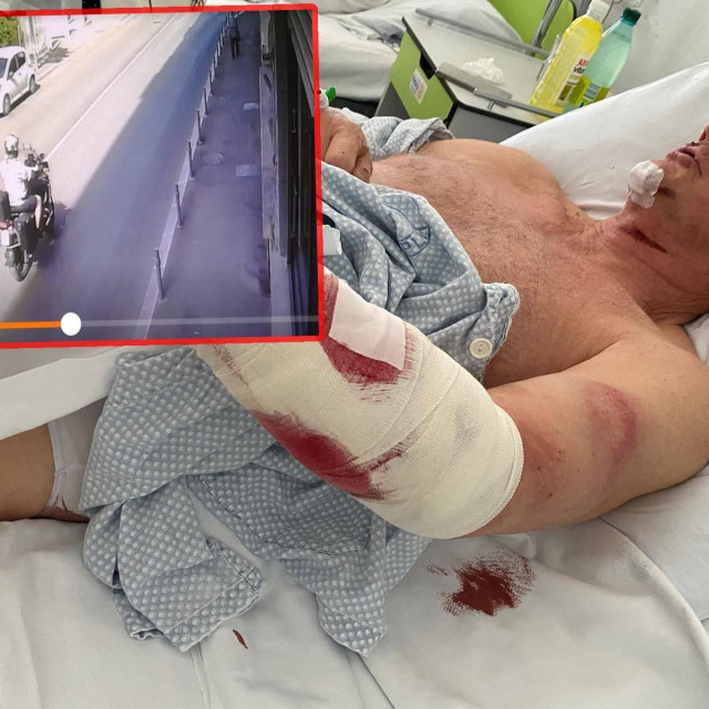 &lt;p&gt;Snimka nepoznatog motoriste; Ozlijeđeni Vedran Jelić u bolničkoj sobi&lt;/p&gt;