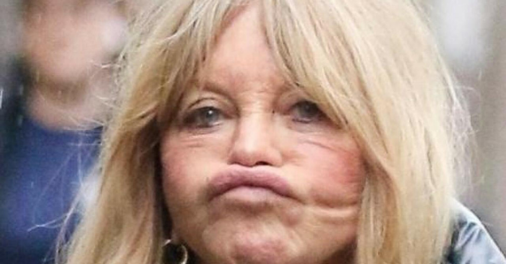 &lt;p&gt;Goldie Hawn mnoge je iznenadila svojim ‘izdanjem‘&lt;/p&gt;