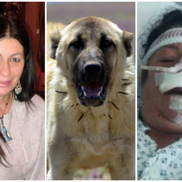 &lt;p&gt;Gordana Martinec prije napada psa i u splitskoj bolnici nakon operacije; Kangalski ovčar/Ilustracija&lt;/p&gt;