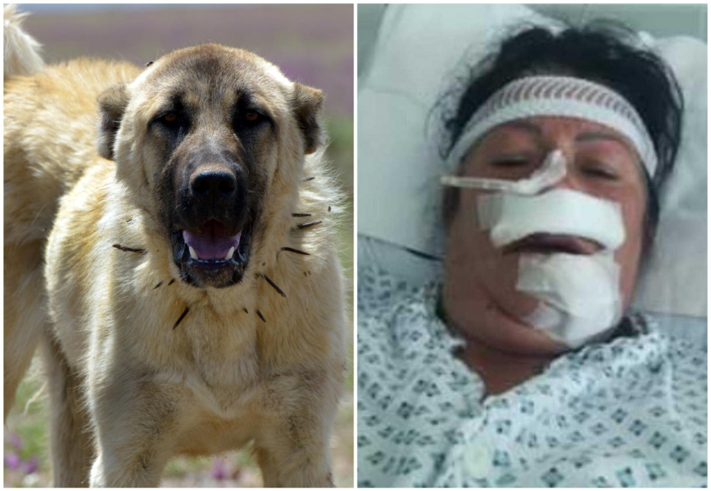 &lt;p&gt;Gordana Martinec u KBC Split nakon operacije od ugriza psa; Turski kangalski ovčar/Ilustracija&lt;/p&gt;