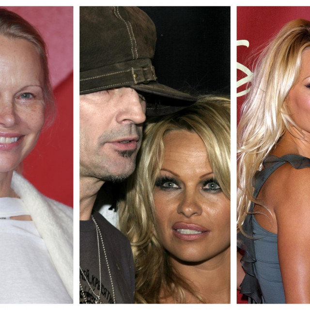 &lt;p&gt;Pamela Anderson danas, s bivšim suprugom Tommyjem Leejem (u sredini) i nekad (desno)&lt;/p&gt;