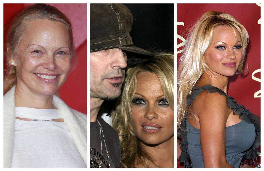 &lt;p&gt;Pamela Anderson danas, s bivšim suprugom Tommyjem Leejem (u sredini) i nekad (desno)&lt;/p&gt;