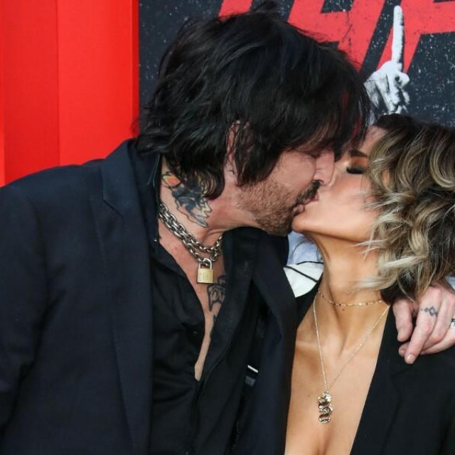 &lt;p&gt;Tommy Lee i supruga Brittany Furlan koja se pokazala znatno hrabrijom od njega&lt;/p&gt;