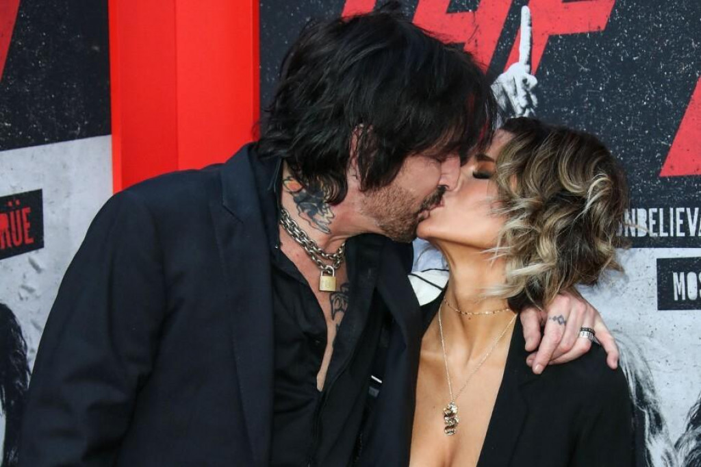 &lt;p&gt;Tommy Lee i supruga Brittany Furlan koja se pokazala znatno hrabrijom od njega&lt;/p&gt;