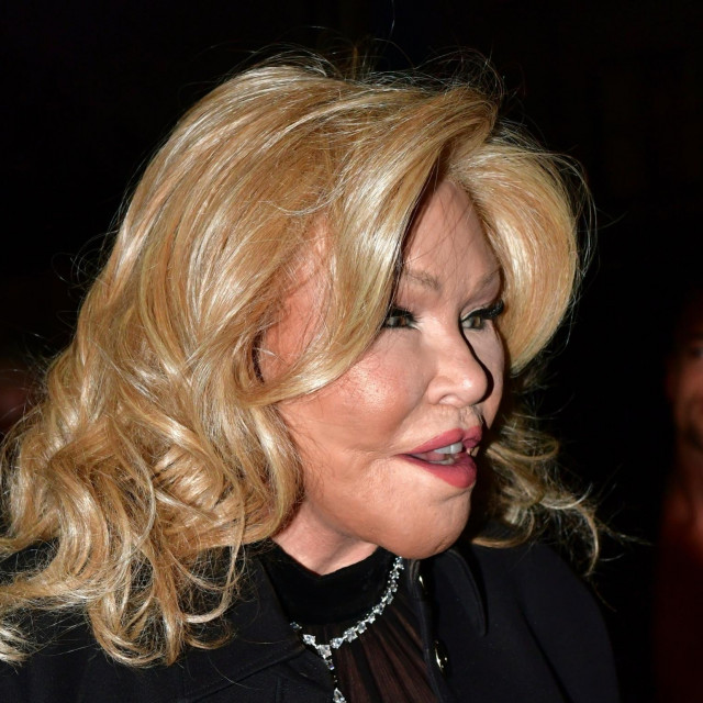 &lt;p&gt;Jocelyn Wildenstein &lt;/p&gt;