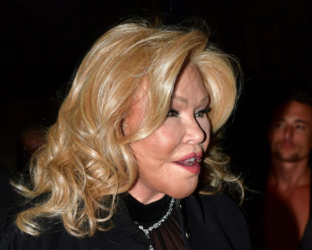 &lt;p&gt;Jocelyn Wildenstein &lt;/p&gt;