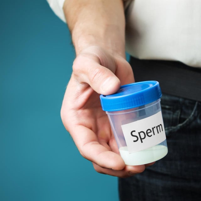 <p>Posuda sa spermom</p>
