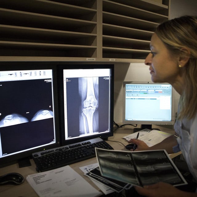 <p>Rendgenska snimka&nbsp;koljena koja prikazuje početke osteoartritisa</p>