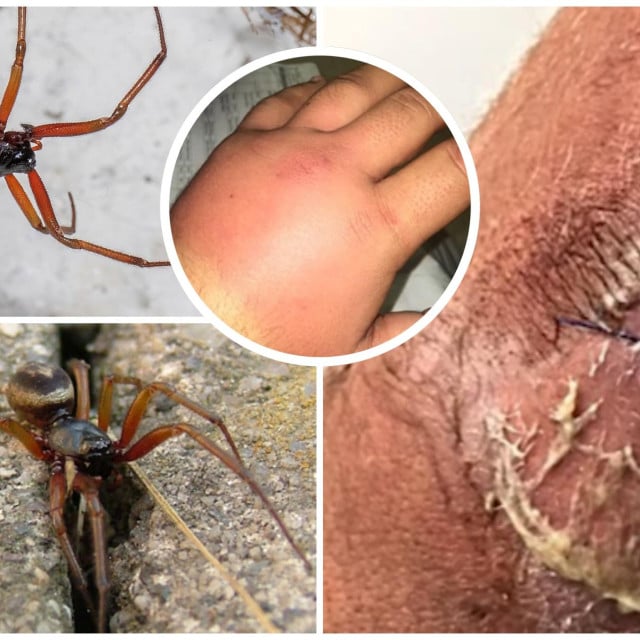 <p>Lažna crna udovica, vrsta Steatoda nobilis (WIKIPEDIA)</p>