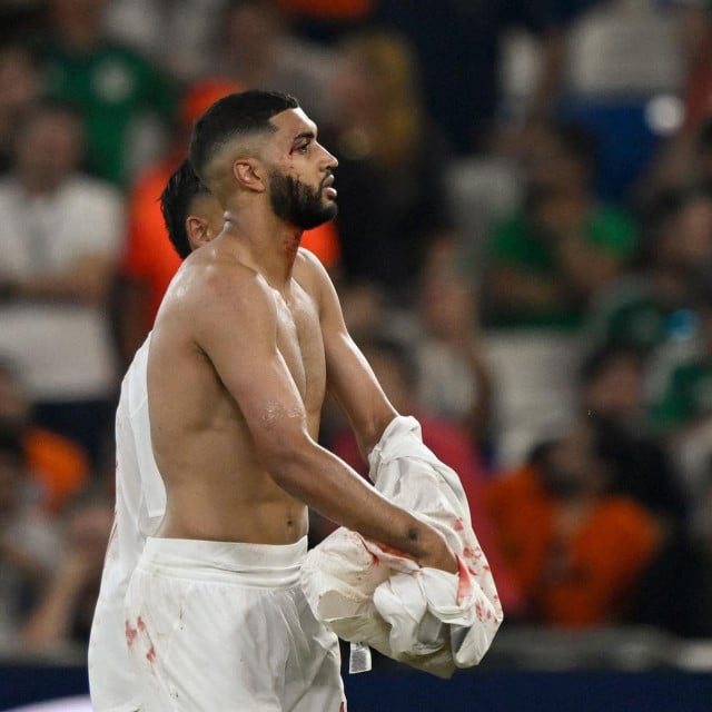 <p>Morocco&lsquo;s midfielder #11 Ismael Saibari leaves the field bleeding during the 2026 World Cup round of 32 football match between the Netherlands and Morocco at the Monterrey Stadium in Guadalupe on June 29, 2026. (Photo by Alfredo ESTRELLA/AFP)</p>