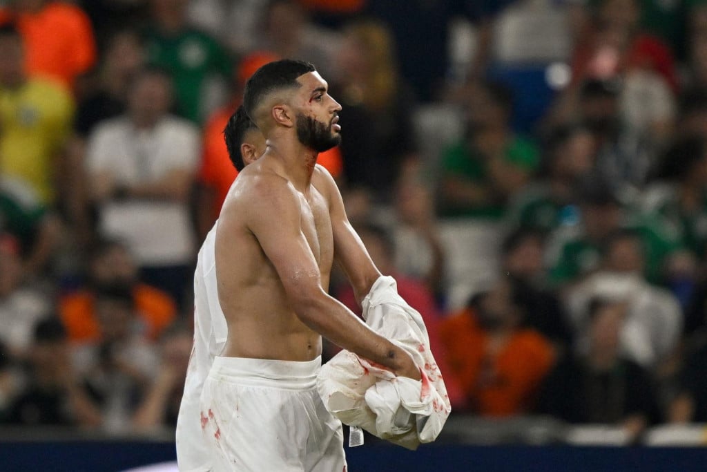 <p>Morocco&lsquo;s midfielder #11 Ismael Saibari leaves the field bleeding during the 2026 World Cup round of 32 football match between the Netherlands and Morocco at the Monterrey Stadium in Guadalupe on June 29, 2026. (Photo by Alfredo ESTRELLA/AFP)</p>
