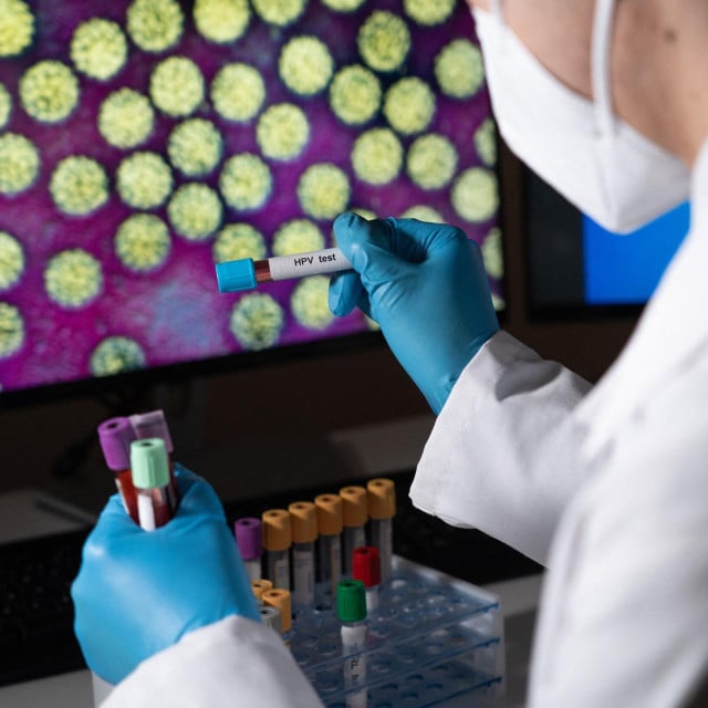 <p>Test za Humani papilomavirus</p>