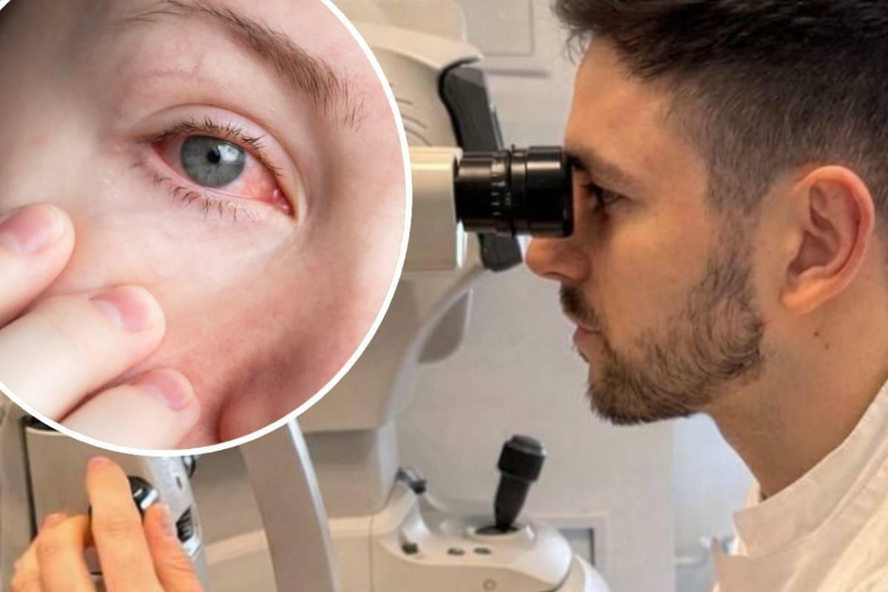 U Splitu i okolici zabilježena epidemija zaraznog adenovirusnog konjunktivitisa