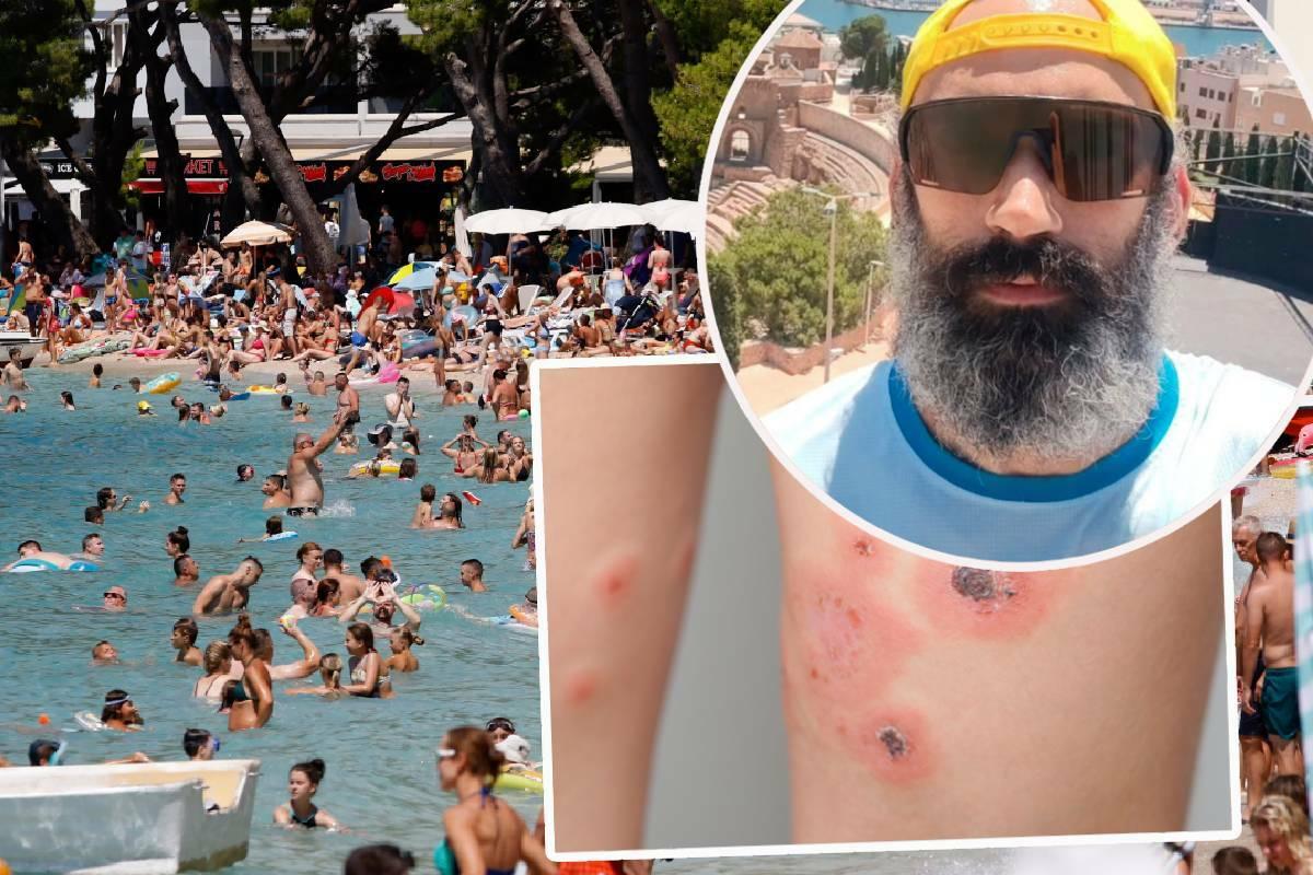 Gadna zaraza prijeti na našim plažama, glumac upozorio: ‘Sina i mene je razvalilo! Jede meso. A prvi put sam čuo za to‘