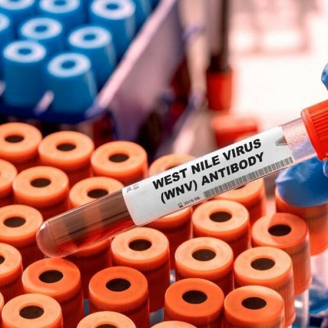 <p>HZJZ je objavio da je u Registru zaraznih bolesti bilo &scaron;est prijava infekcije, od kojih su tri osobe zbog teže kliničke slike bile hospitalizirane, dok su tri infekcije bile asimptomatske&nbsp;</p>
