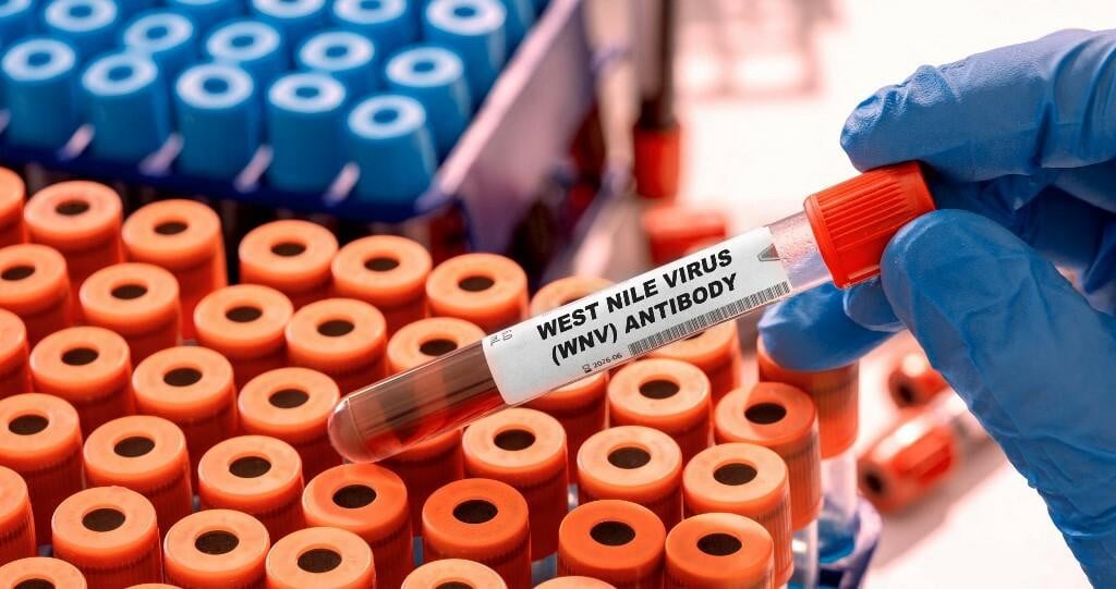 <p>HZJZ je objavio da je u Registru zaraznih bolesti bilo &scaron;est prijava infekcije, od kojih su tri osobe zbog teže kliničke slike bile hospitalizirane, dok su tri infekcije bile asimptomatske&nbsp;</p>