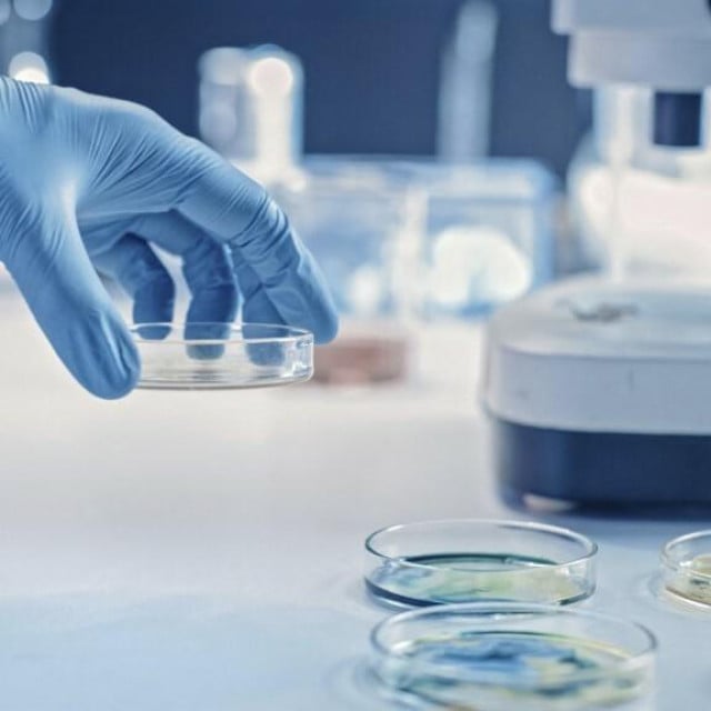 <p>U Rusiji je izbila sumnja na epidemiju kuge. Mlada laboratorijska tehničarka je preminula, a&nbsp; gotovo 200 ljudi natjerano je u izolaciju&nbsp;(ilustracija)&nbsp;</p>