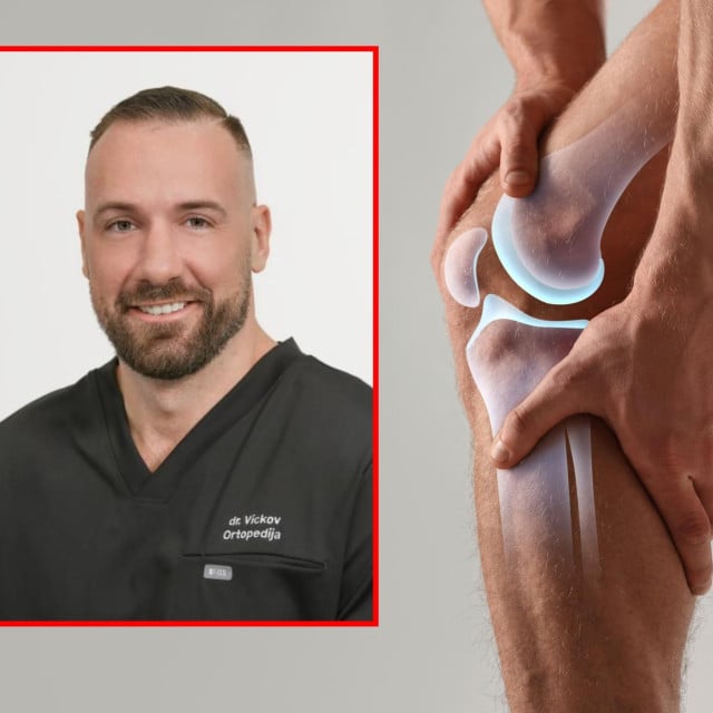 <p>Kada operacija koljena zaista ima smisla, a kada je bolje poku&scaron;ati s neoperativnim liječenjem? O tome smo razgovarali s<strong>&nbsp;</strong>dr.<strong> </strong>Josipom Vickovom</p>
