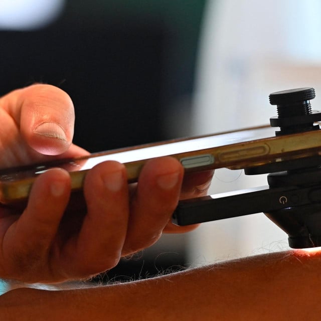 <p>A physical therapist examines a patient&lsquo;s skin using a smartphone and a dermatoscope, part of a scheme to train physical therapists to screen for skin cancer before referring patients to specialists for diagnosis, in Montpellier, southern France, on September 26, 2026. Faced with a shortage of dermatologists, physiotherapists in France&lsquo;s Occitanie region are being trained to spot melanomas in their patients, helping them gain precious time in the fight against skin cancer. The initiative, described as a French first, aims to train 100 physiotherapists by the end of the year. (Photo by Sylvain THOMAS/AFP)</p>