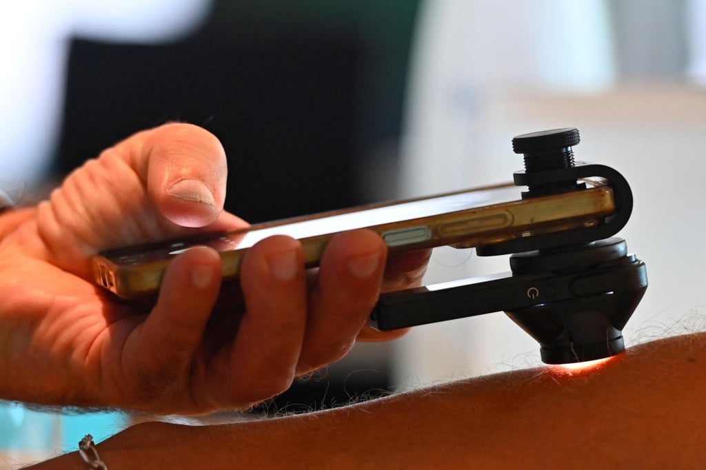 <p>A physical therapist examines a patient&lsquo;s skin using a smartphone and a dermatoscope, part of a scheme to train physical therapists to screen for skin cancer before referring patients to specialists for diagnosis, in Montpellier, southern France, on September 26, 2026. Faced with a shortage of dermatologists, physiotherapists in France&lsquo;s Occitanie region are being trained to spot melanomas in their patients, helping them gain precious time in the fight against skin cancer. The initiative, described as a French first, aims to train 100 physiotherapists by the end of the year. (Photo by Sylvain THOMAS/AFP)</p>